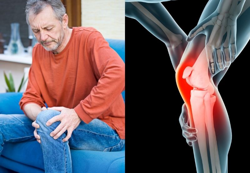 Managing Joint Pain Without Knee Replacement Surgery