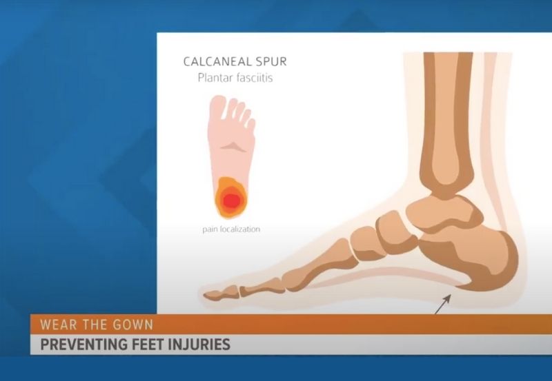 Preventing Foot Injuries During Exercise